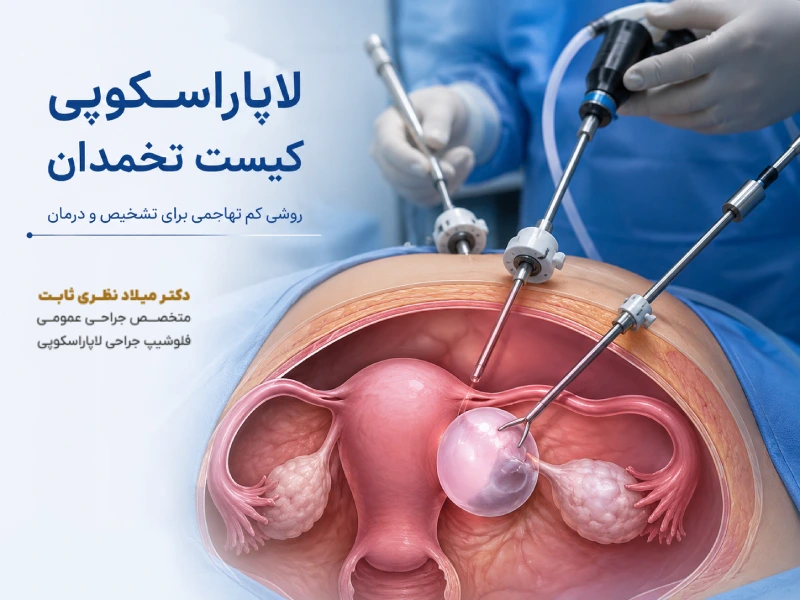 لاپاراسکوپی کیست تخمدان در رشت