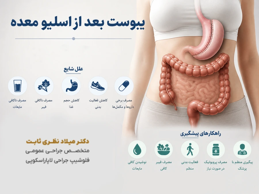 یبوست بعد از اسلیو معده