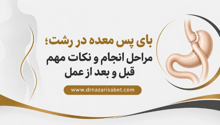 بای پس معده در رشت