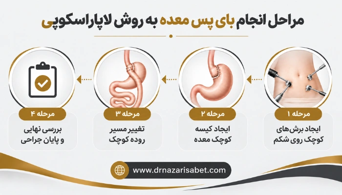 مراحل انجام بای پس معده به روش لاپاراسکوپی