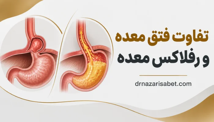 تفاوت فتق معده و رفلاکس معده با نمایش جابهجایی معده و بازگشت اسید به مری