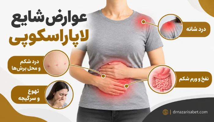 درد شکم، نفخ، درد شانه و تهوع بعد از لاپاراسکوپی