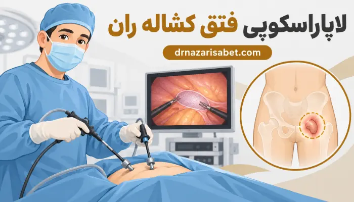 لاپاراسکوپی فتق کشاله ران و ترمیم فتق با جراحی کمتهاجمی